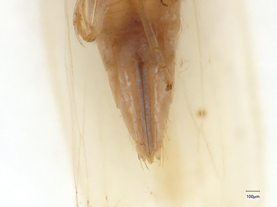 Abdomen of an adult female corn leafhopper.