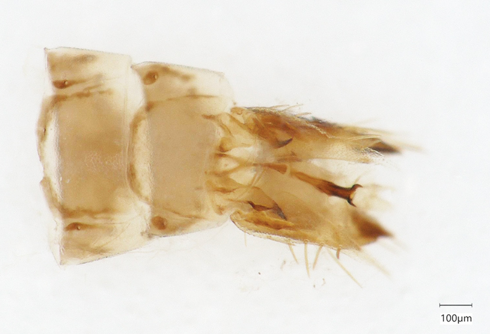 Close up of the male corn leafhopper genitalia at the end of the abdomen, showing the two hooks.